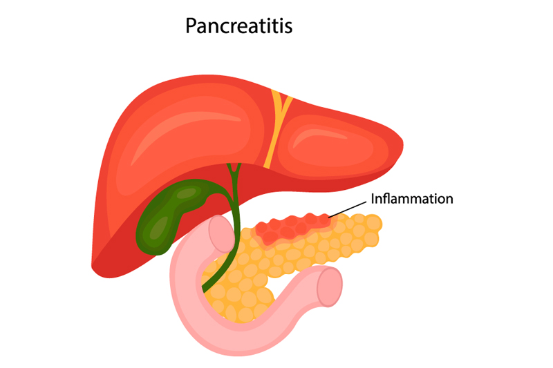 Pancreato-biliary care